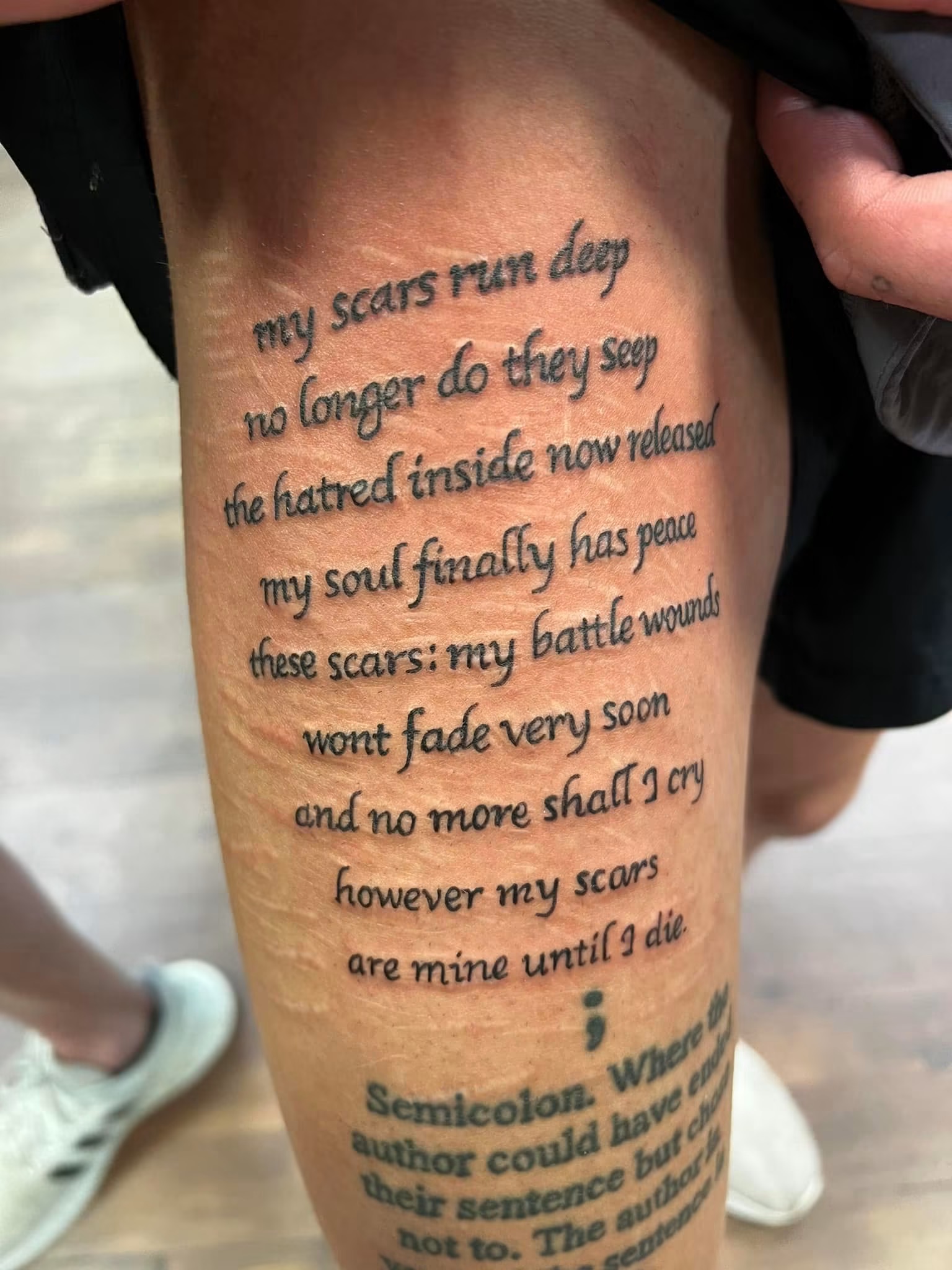 Script tattoo incorporating scar tissue after tattooing